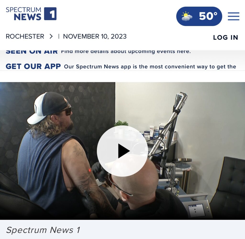 Bald man performing laser tattoo removal on man with backwards hat and glasses.