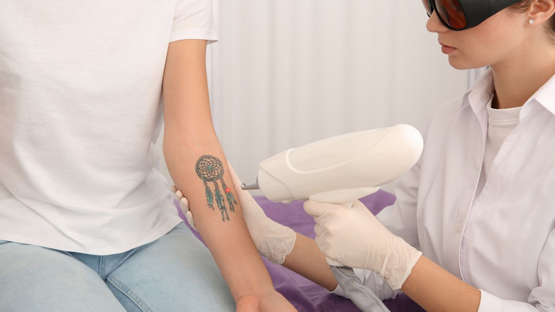 Client receiving laser tattoo removal treatment on their arm, showing the procedure in action