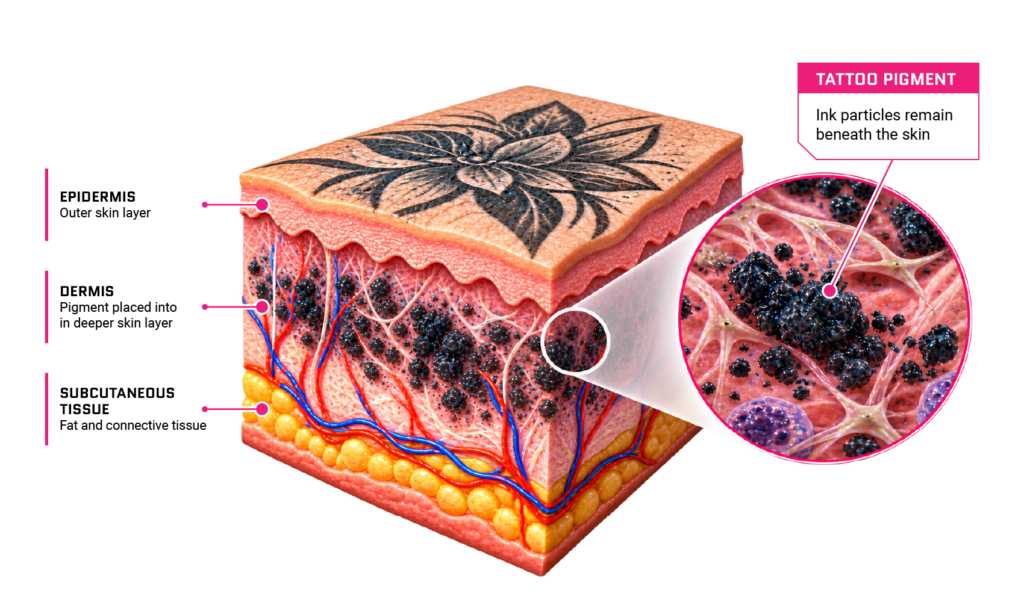 Tattoo skin diagram showing ink pigment embedded in the dermis beneath the epidermis.